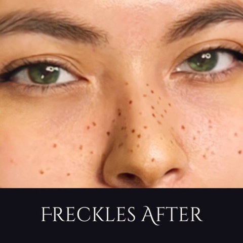 FaceTune Freckles